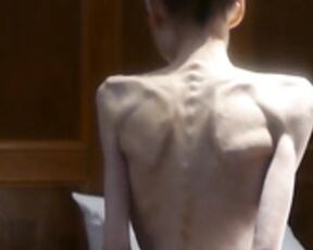 anorexic Christin 7F2xo